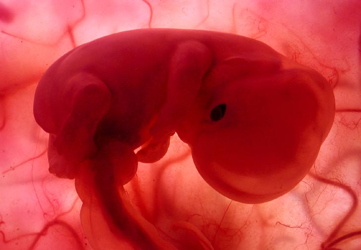 Mortalidad fetal en las Américas: desafíos conceptuales y operativos.